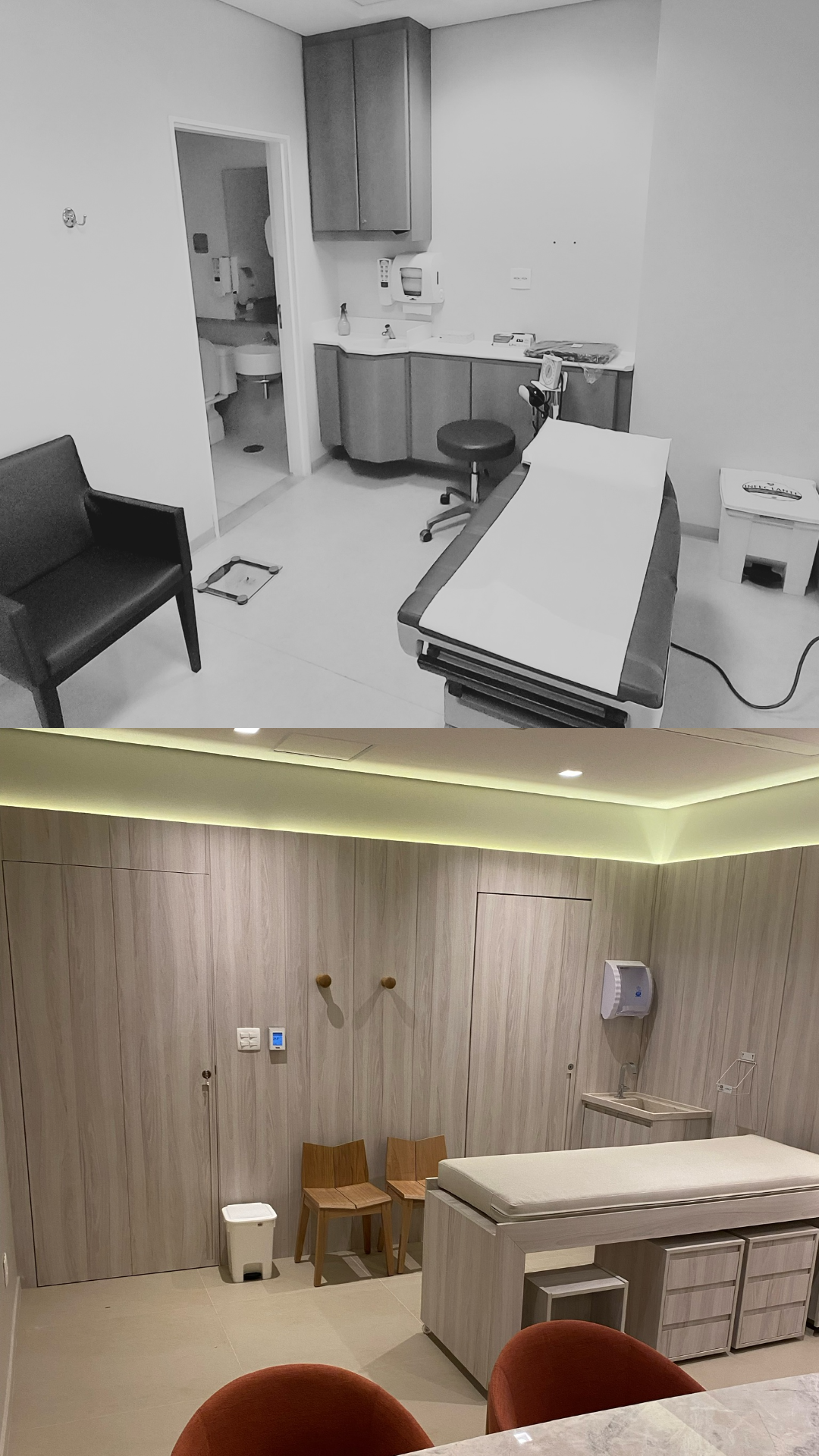 Antes e Depois 4